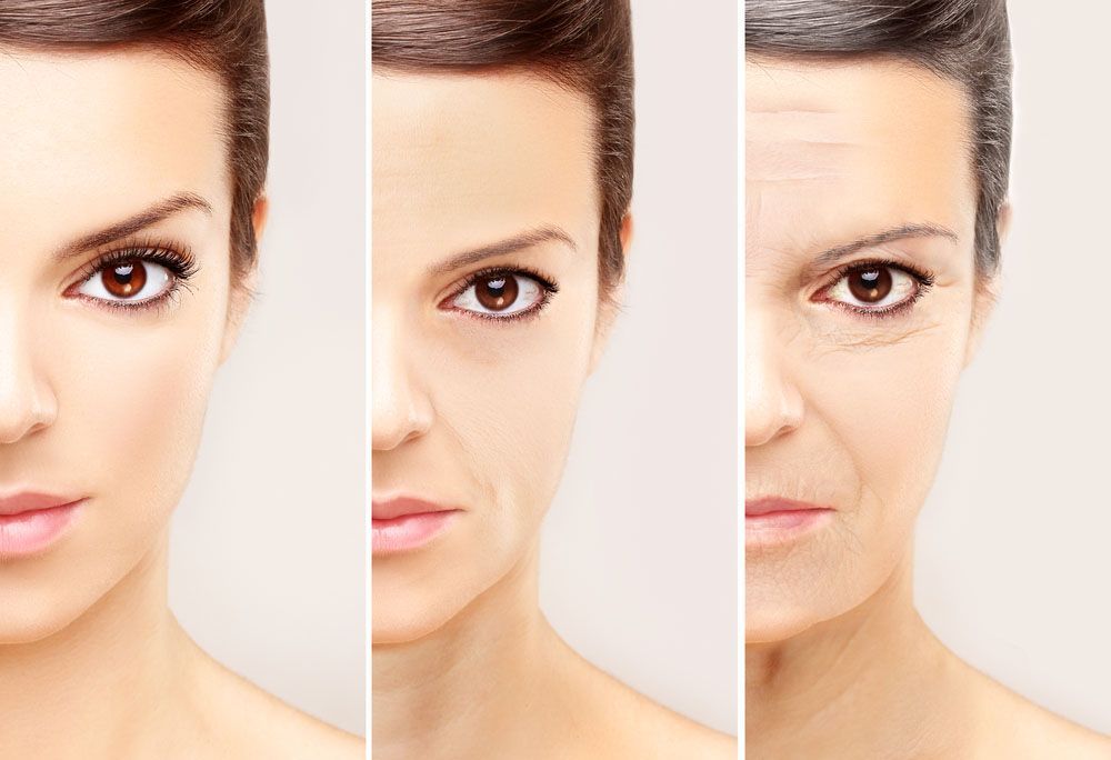 Botox® para tratamiento de arrugas y surcos faciales